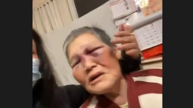 cbsn-fusion-asian-attack-victim-fights-back-san-francisco-thumbnail-671882-640x360.jpg 