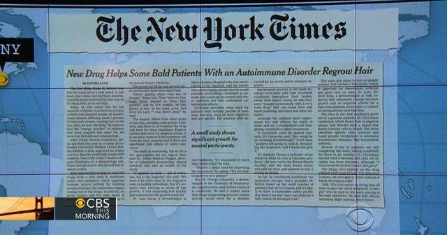 7:30 Headlines: A new drug may help bald people grow new hair - CBS News