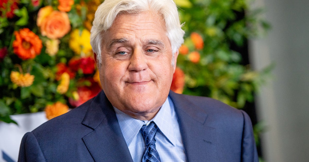 Jay Leno in stable condition after suffering "serious burns" from gasoline fire