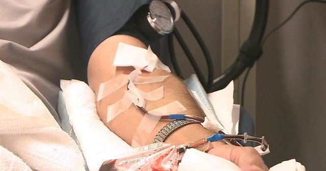 FDA considers lifting ban on blood donations from gay men - CBS News