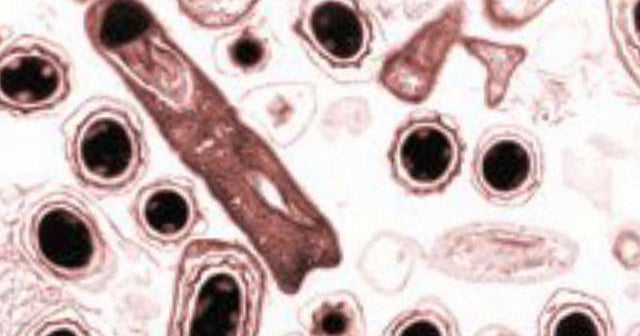Pentagon shipped live Anthrax sample to nine states and South Korea ...