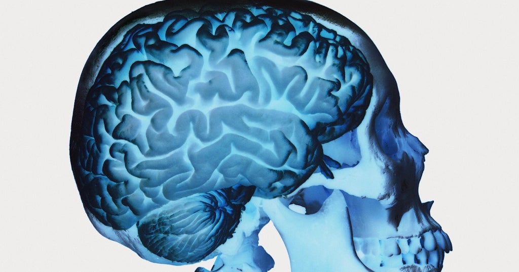 A 319millionyearold brain has been discovered. It could be the