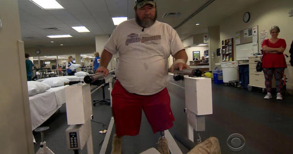 Vet caught up in VA bureaucracy finally walking again - CBS News