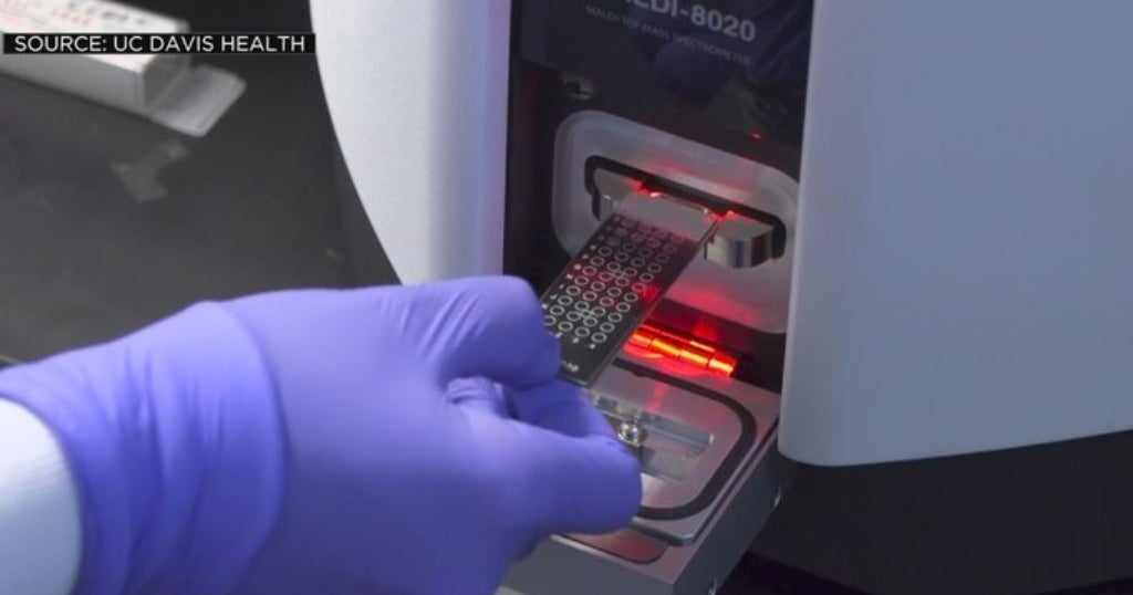 New Rapid COVID19 Test Developed By UC Davis And SpectraPass Able 'To