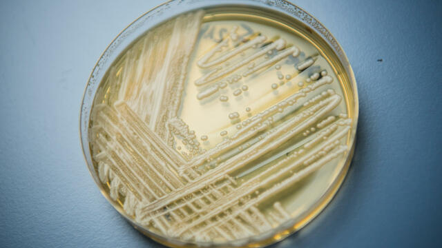 cbsn-fusion-cdc-superbug-fungus-outbreak-dallas-texas-washington-dc-thumbnail-759591-640x360.jpg 