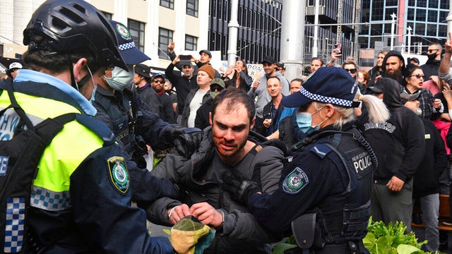 Virus Outbreak Australia 