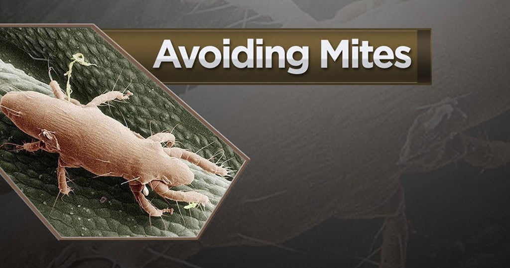 'Itchy Mites' Preventing Bites And The Itch That Comes With A Mite Bite CBS Pittsburgh