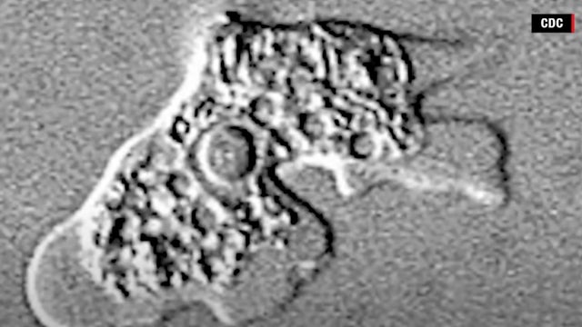 brain-eat_amoeba.jpg 
