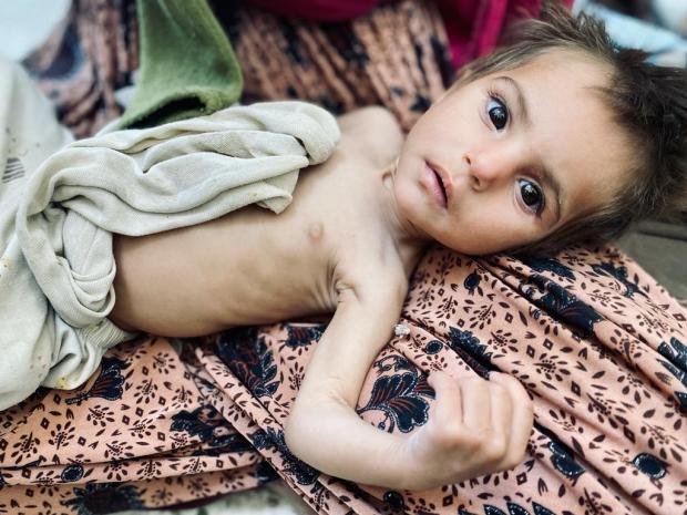 afghanistan-starving-child.jpg 