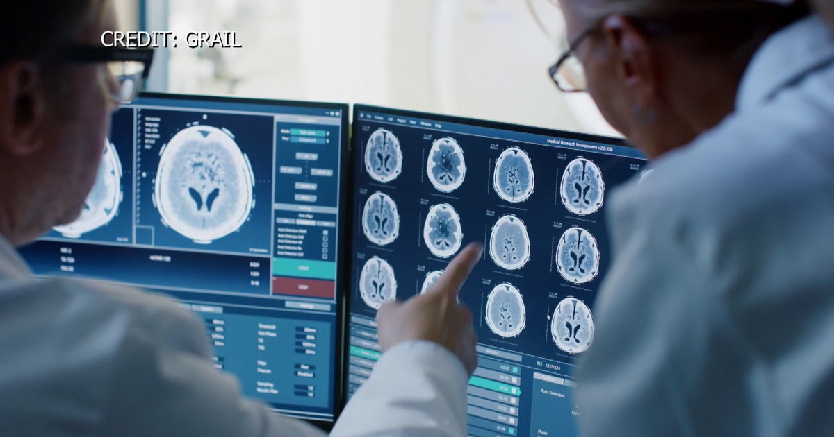 'This Is A GameChanger' New Test Can Detect Over 50 Types Of Cancer