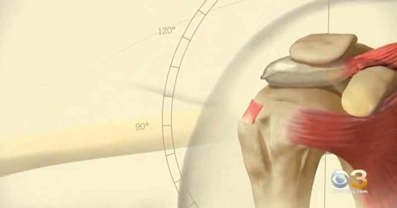 FDACleared InSpace Balloon Being Hailed Game Changer In Repairing Torn