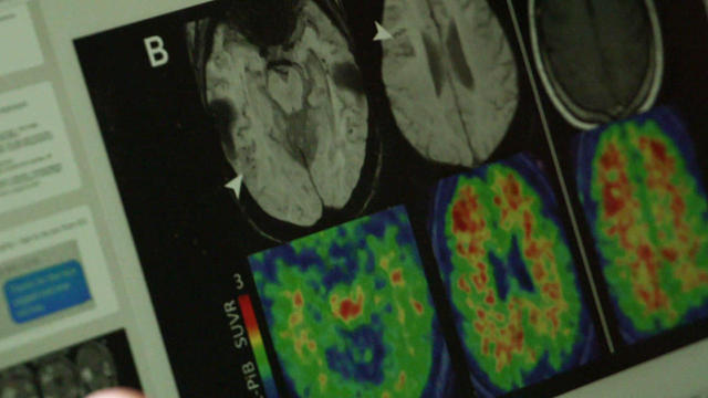 mri-brain-scans-1280.jpg 
