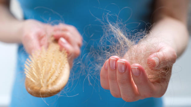 Hair-Loss-comb.jpg 