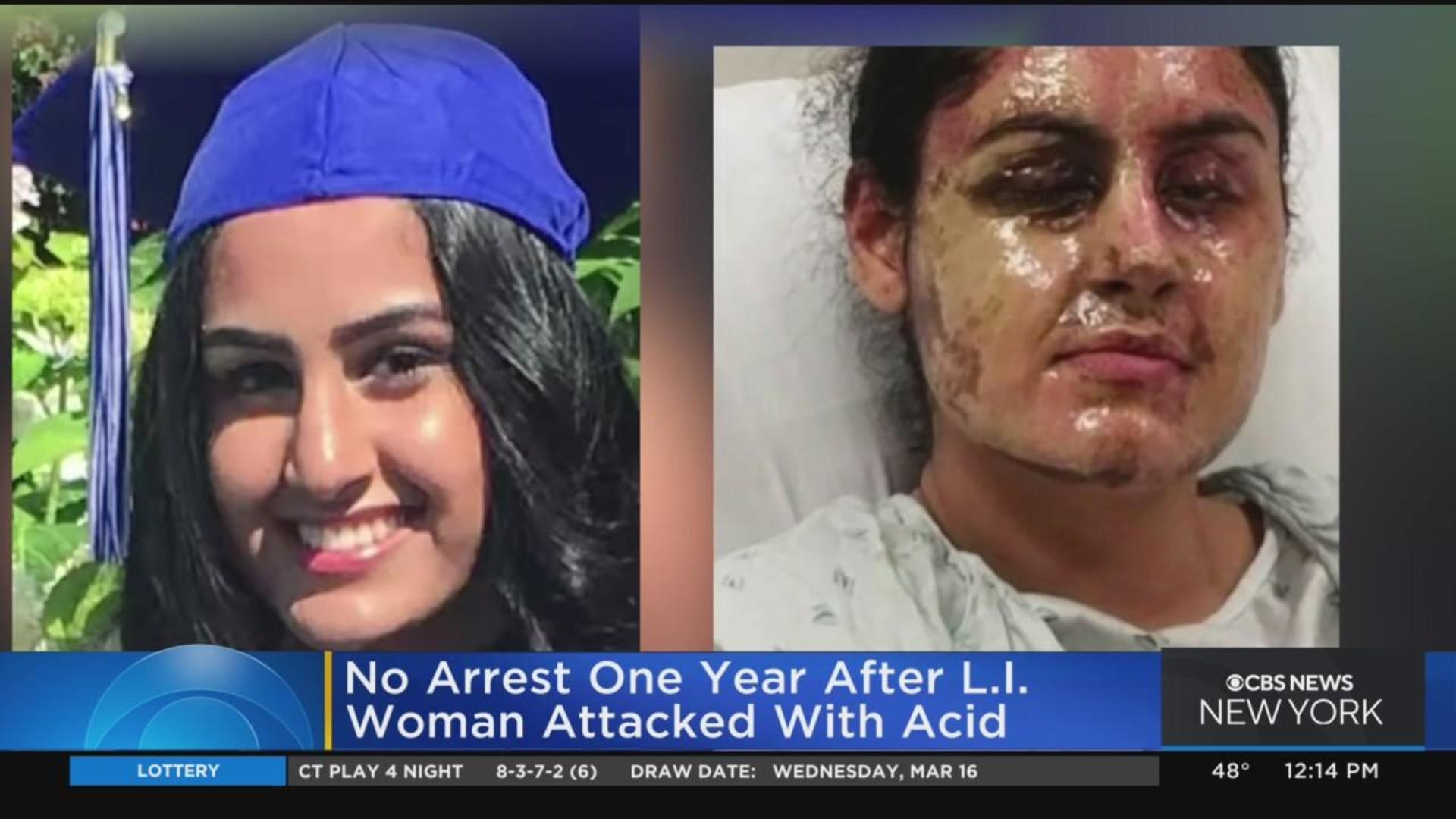 California Woman, Former Beauty Queen, Survives Acid Attack and Works to  Raise Awareness - California Newswire