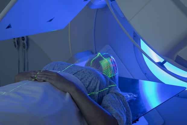 Woman Receiving Radiation Therapy Treatments for Head &amp; NeckCancer 