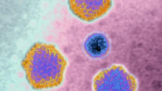 cbsn-fusion-hepatitis-outbreak-among-children-grows-in-us-thumbnail-984361-640x360.jpg 
