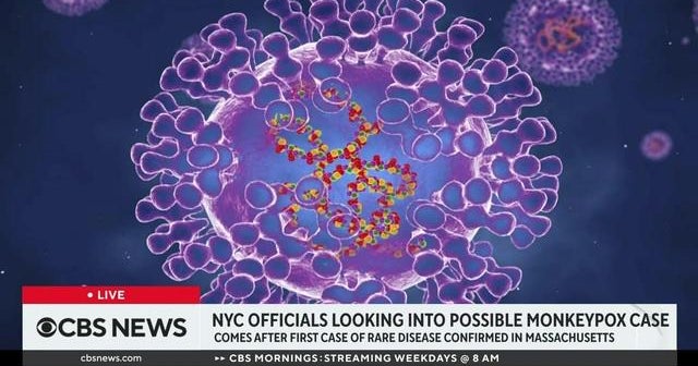 Health officials investigating possible monkeypox case in New York City