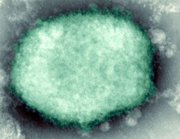 Monkeypox Virus 