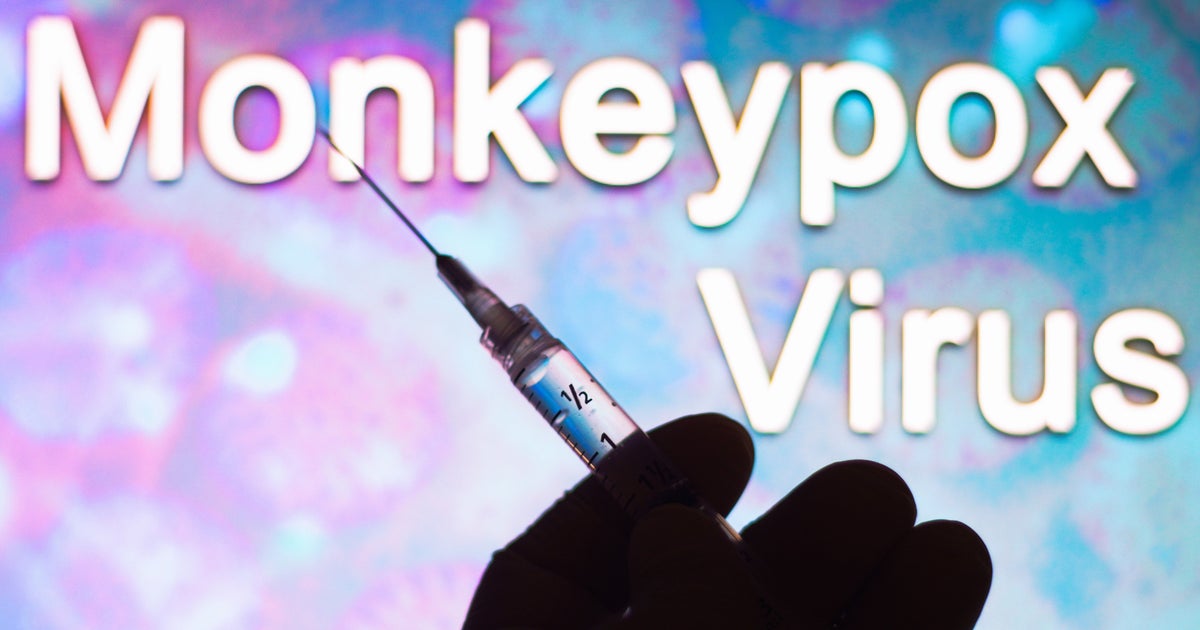 U.S. Offers Vaccines To Certain People Exposed To Monkeypox. Here's ...