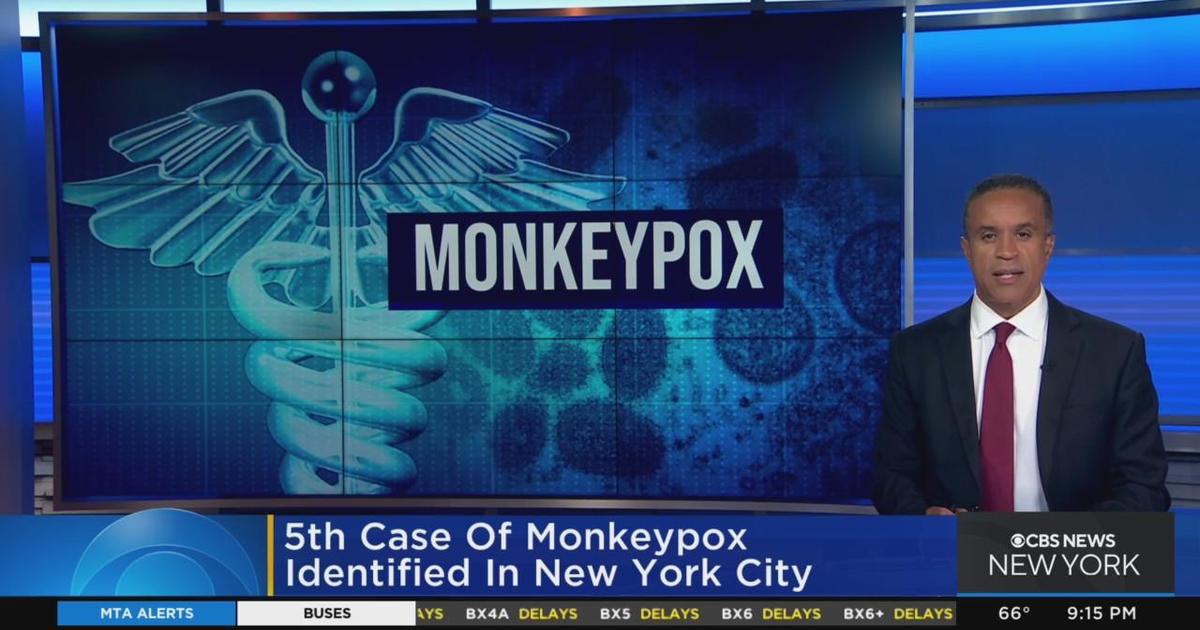 5th Case Of Monkeypox Identified In New York City - CBS New York