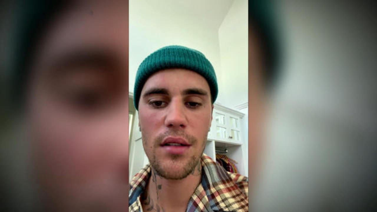 Justin Bieber is all smiles with facial paralysis update