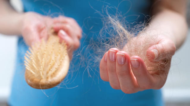 A woman holds a wooden comb in her hands, cleans it of fallen hair after combing. The concept of head health problems, deficient conditions in the body due to stress and depression, a consequence of chemotherapy and radiation for cancer. 