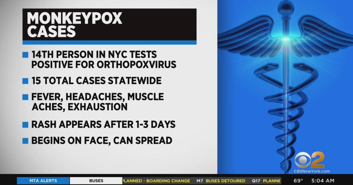 Another monkeypox case in NYC CBS New York