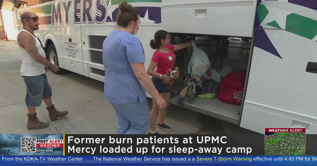 Burn patients from UPMC Mercy head to sleepaway camp CBS Pittsburgh