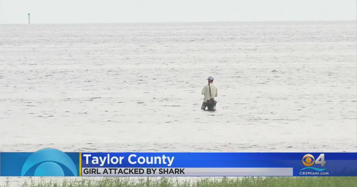 Teenage girl seriously injured in shark attack in Florida - CBS Miami