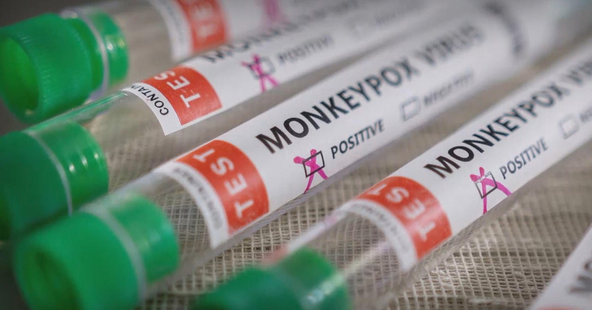 Monkeypox officially becomes a global emergency