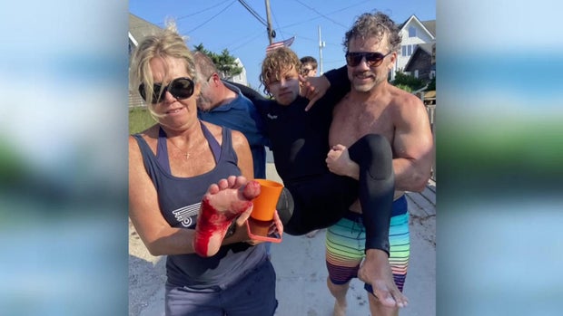 teen-surfer-attacked-by-shark-on-fire-island.jpg 
