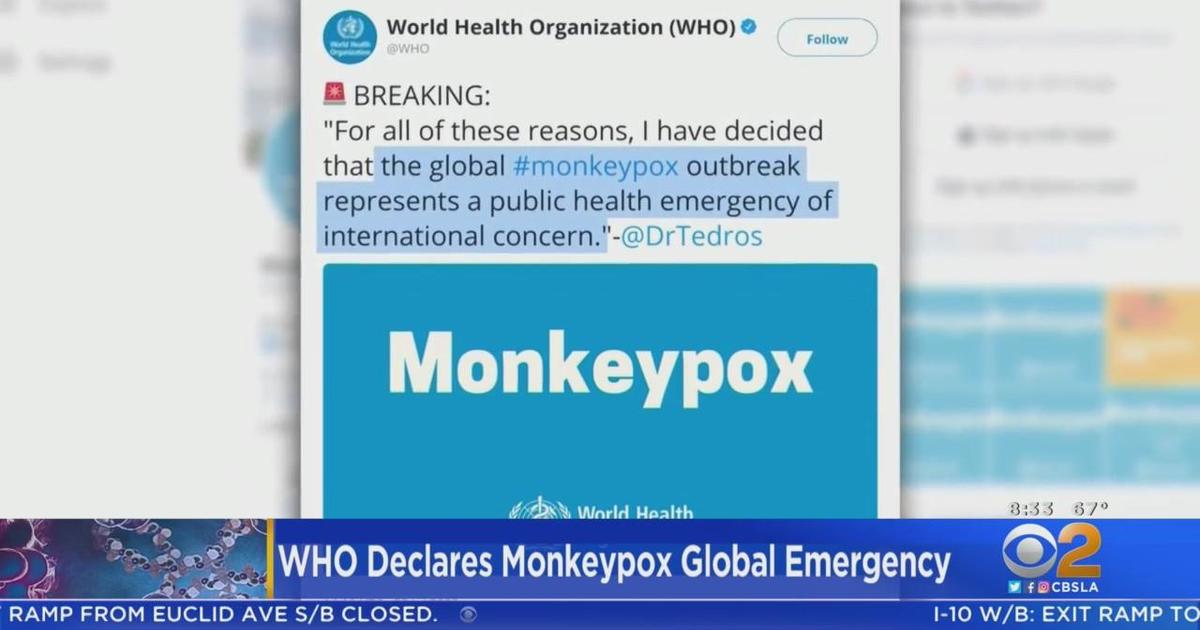 WHO declares monkeypox outbreak a "public health emergency" CBS Los