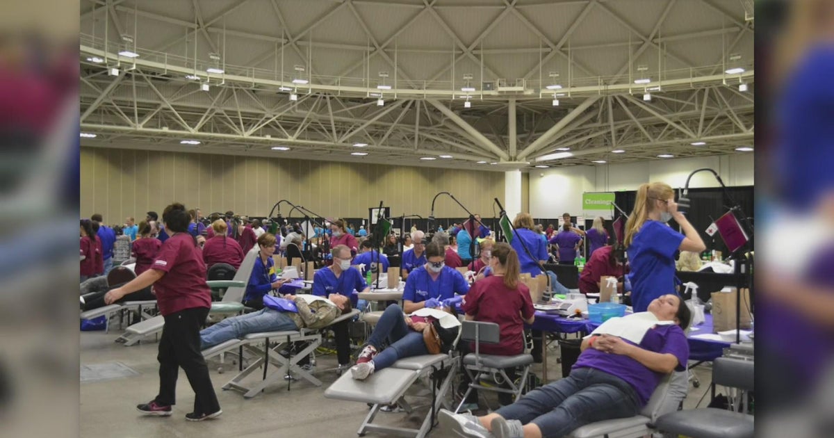 Volunteer event in St. Cloud provides free dental care CBS Minnesota