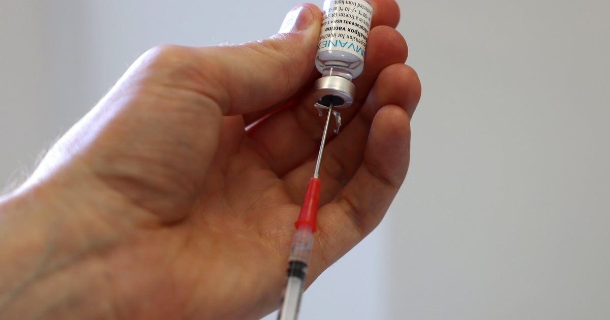 Monkeypox cases in Maryland surpass 110, CDC data show CBS Baltimore