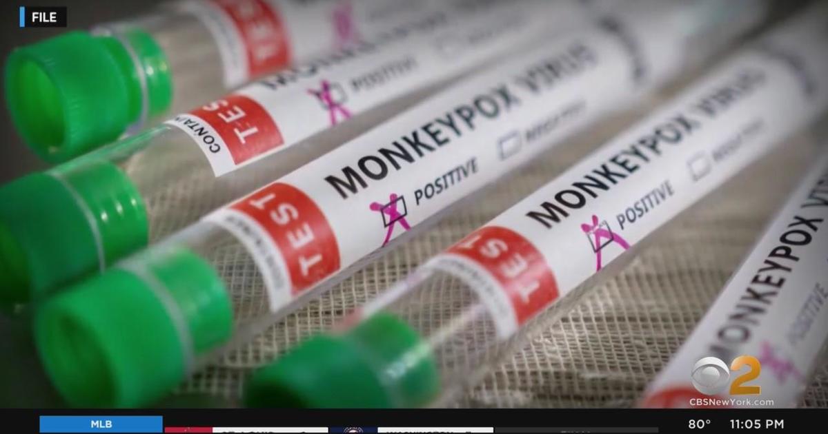 New York City Declares Monkeypox A Public Health Emergency - CBS New York