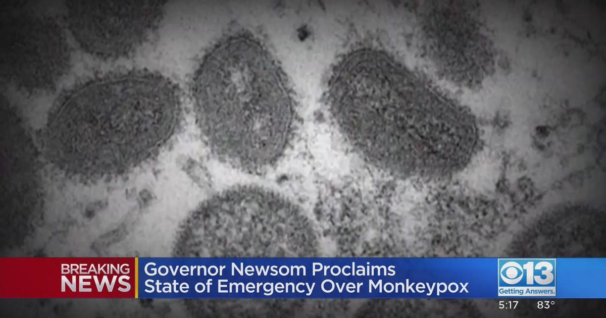 Gov. Newsom Declares State Of Emergency In Response To Monkeypox ...