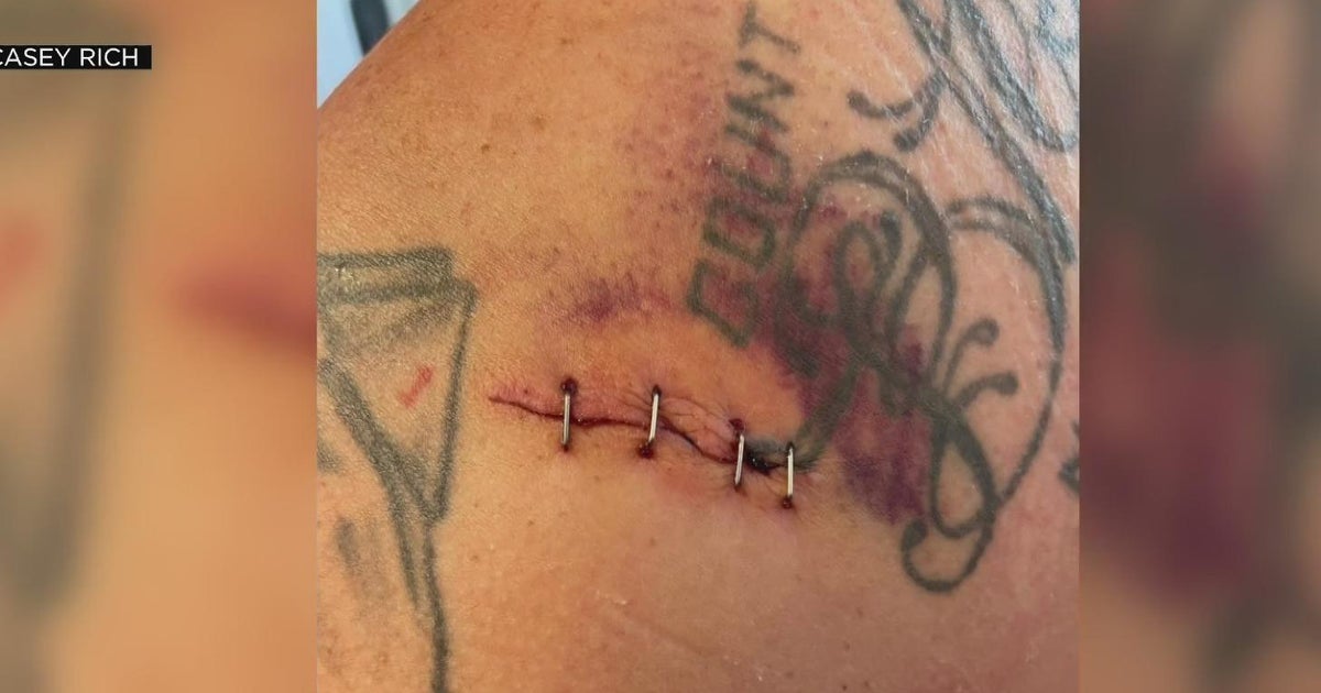 Man stabbed 10 times by Door Dash driver speaks for first time