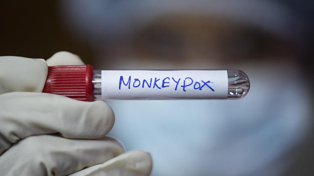 Photo Illustration Of Monkeypox Virus 