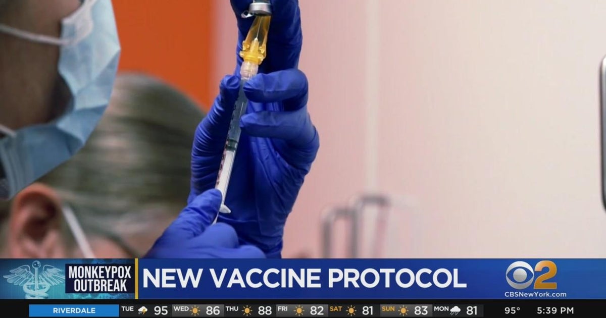 New protocol will stretch amount of monkeypox vaccine doses - CBS New York