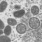 Second person in the U.S. dies after contracting monkeypox