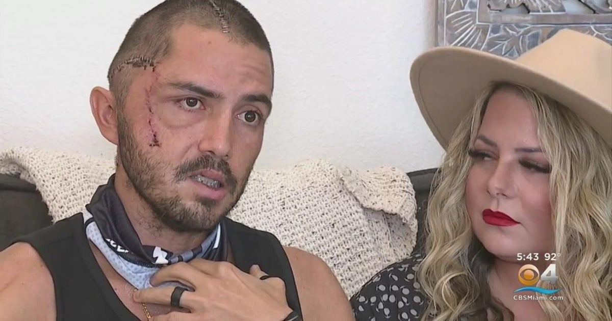 Florida man is thankful to be alive after an alligator attack caught on drone cam