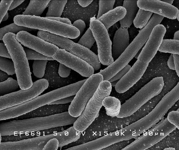 E. coli bacteria 