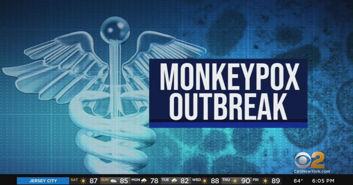 First pediatric case of monkeypox in New York reported CBS New York