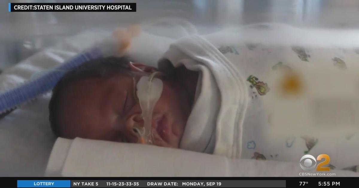 Staten Island University Hospital Welcomes 5 Sets Of Twins Cbs New York