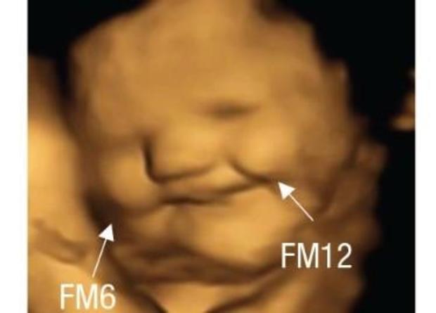 Fetuses apparently like carrots, but kale? Not so much, ultrasounds show