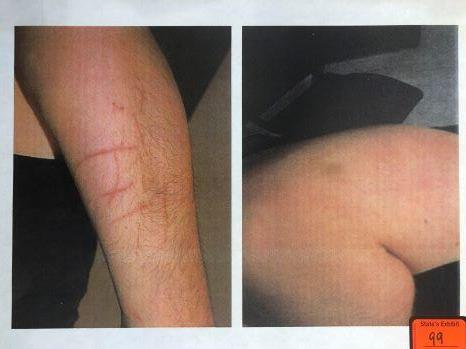 Lori Slesinski evidence
