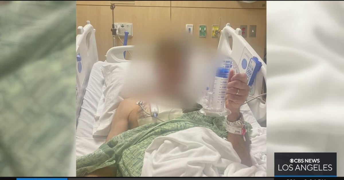 Man brutally injured after attacked by homeless men in Studio City - Vimarsana News