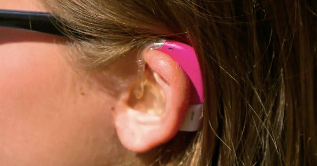 Hearing Aids Advertised On Fox News What to know about over-the-counter hearing aids - CBS News