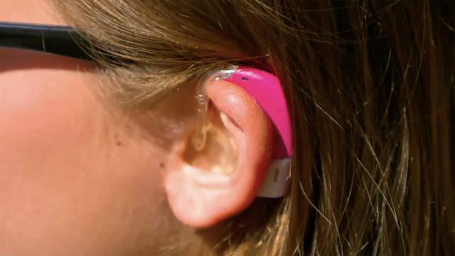 1013-np-hearingaids-1378598-640x360.jpg 