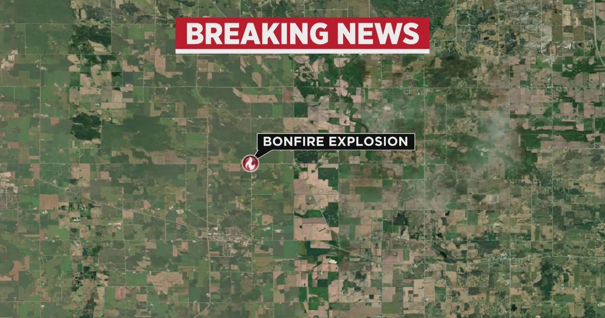 Bonfire explosion in Wisconsin leaves several teens hospitalized